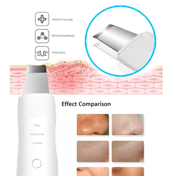 Ultrasonic Skin Spatula 3-in-1